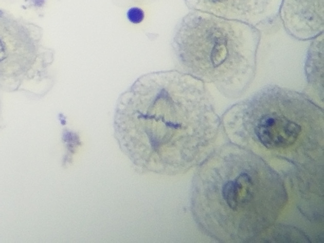 White Fish Mitosis Slides - White Fish Mitosis 016 400X